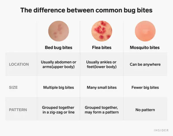 Mosquito Bites VS Flea Bites 